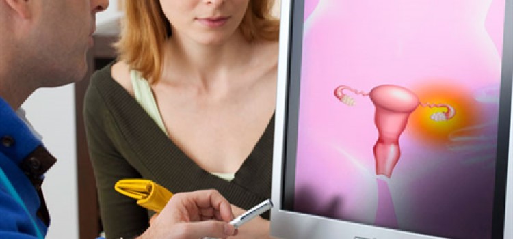 Segredos Sobre a Endometriose